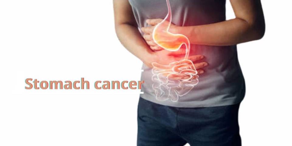 stomach-cancer-all-you-need-to-know