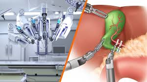 Robotic Surgery