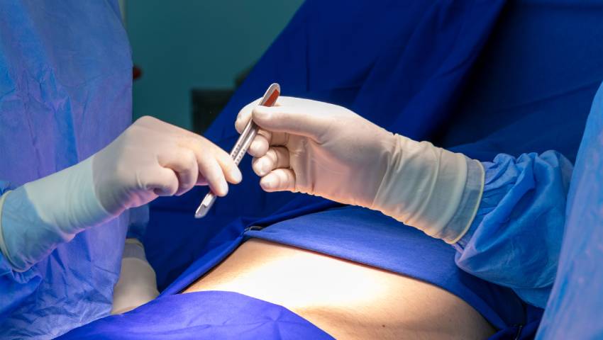 Surgical Options for Crohn’s and Colitis Patient